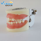 VIC-E15 Teeth Study Model Artificial Physician Certified Tooth Extraction Model