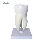 Teeth Anatomical Model Molar Tooth Attach With Caries Maxillary 3 Roots Magnify