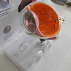 Glaucoma Model Plastic Eyes Models Eye Diseases Model Cataract Eye Model