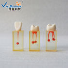 Transparent Tooth Root Canal Dental Study Models Life Size Teaching Model