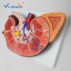 Enlarged Kidney Human Anatomical Model 1 Part Medical Life Size