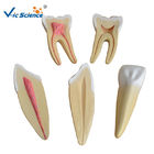 19x16x11cm Dental Study Models