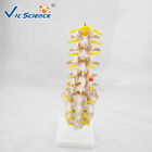 Life Size PVC Lumbar Vertebrae Model With Sacrum / Coccyx And Herniated Disc