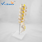 Life Size PVC Lumbar Vertebrae Model With Sacrum / Coccyx And Herniated Disc