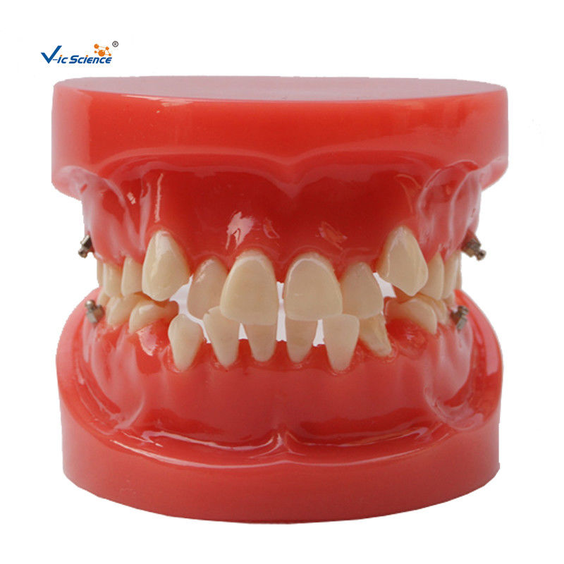 Orthodontic Dental Study Models Tooth Teaching , Dental Models For Patient Education