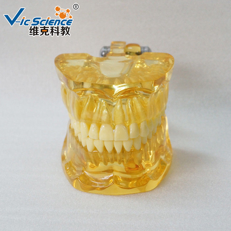 Full Mouth Teeth Pathology Model Teeth Models For Education With Half Implant