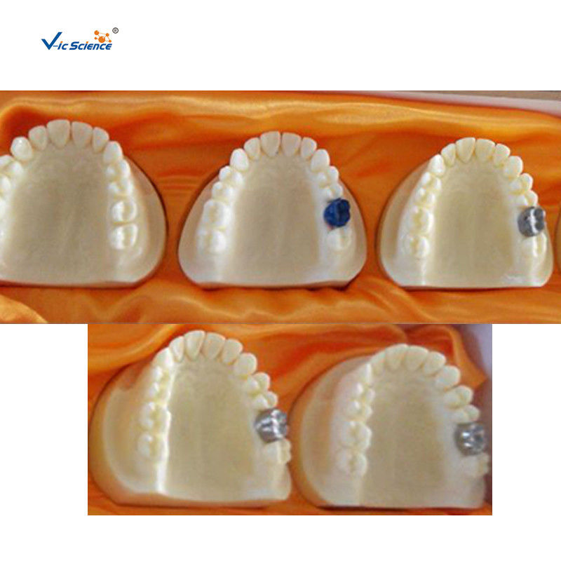 Producing Steps Of Marilan Bridge Dental Study Models For Teeth Teaching